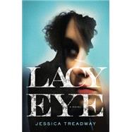Lacy Eye 9781455530380