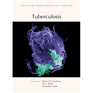 Tuberculosis