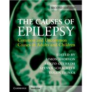 The Causes of Epilepsy 9781108420754