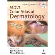 Iadvl Color Atlas of Dermatology 9789385891212