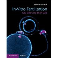 In-vitro Fertilization 9781108441810