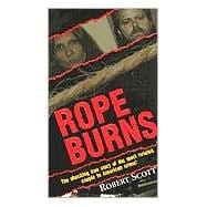 Rope Burns