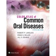 Color Atlas of Common Oral Diseases 9781496332080