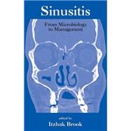 Sinusitis