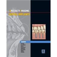 Dental Implants 9781937242190