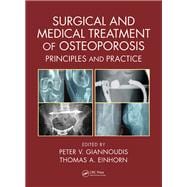 Surgical and Medical Treatment of Osteoporosis: Principles and Practice 9781498732246