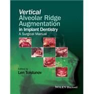 Vertical Alveolar Ridge Augmentation in Implant Dentistry: A Surgical Manual 9781119082590
