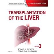Transplantation of the Liver 9781455702688