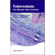Tuberculosis