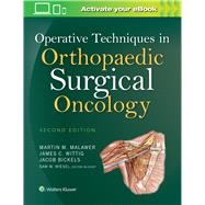 Operative Techniques in Orthopaedic Surgical Oncology 9781451193275
