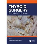 Thyroid Surgery