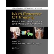 Multi-Detector CT Imaging: Principles, Head, Neck, and Vascular Systems 9781439893807