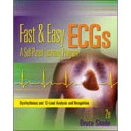 Pocket Guide for Fast and Easy Ecgs 9780077394028