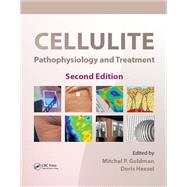 Cellulite