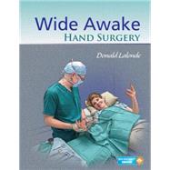 Wide Awake Hand Surgery 9781498714792