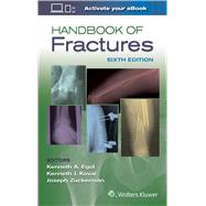 Handbook of Fractures 9781496384850