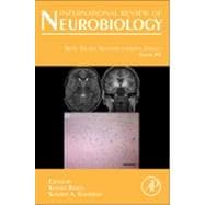 Metal Related Neurodegenerative Disease 9780124105027