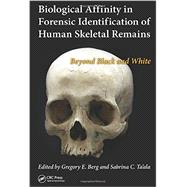 Biological Affinity in Forensic Identification of Human Skeletal Remains: Beyond Black and White 9781439815755