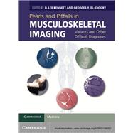 Pearls and Pitfalls in Musculoskeletal Imaging: Variants and Other Difficult Diagnoses 9780521196321