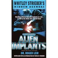 Casebook: Alien Implants