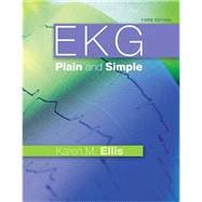 EKG Plain and Simple 9780132377294