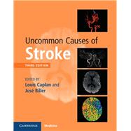 Uncommon Causes of Stroke 9781107147447