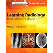 Learning Radiology: Recognizing the Basics 9780323328074