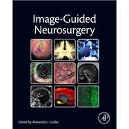 Image-guided Neurosurgery 9780128008706