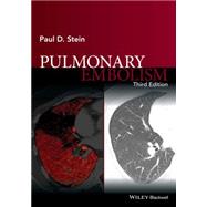 Pulmonary Embolism 9781119039082