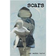 Scars