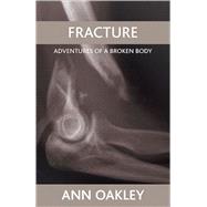 Fracture
