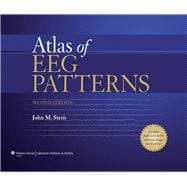 Atlas of Eeg Patterns 9781451109634