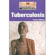 Tuberculosis