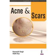 Acne & Scars 9789351529699