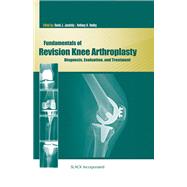 Fundamentals of Revision Knee Arthroplasty Diagnosis, Evaluation, and Treatment 9781556429743