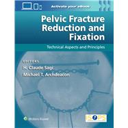 Pelvic Fracture Reduction and Fixation: Technical Aspects and Principles